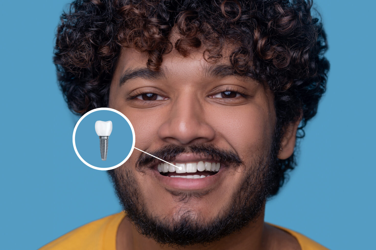 Single Tooth Dental Implants Drouin | Natural Feel