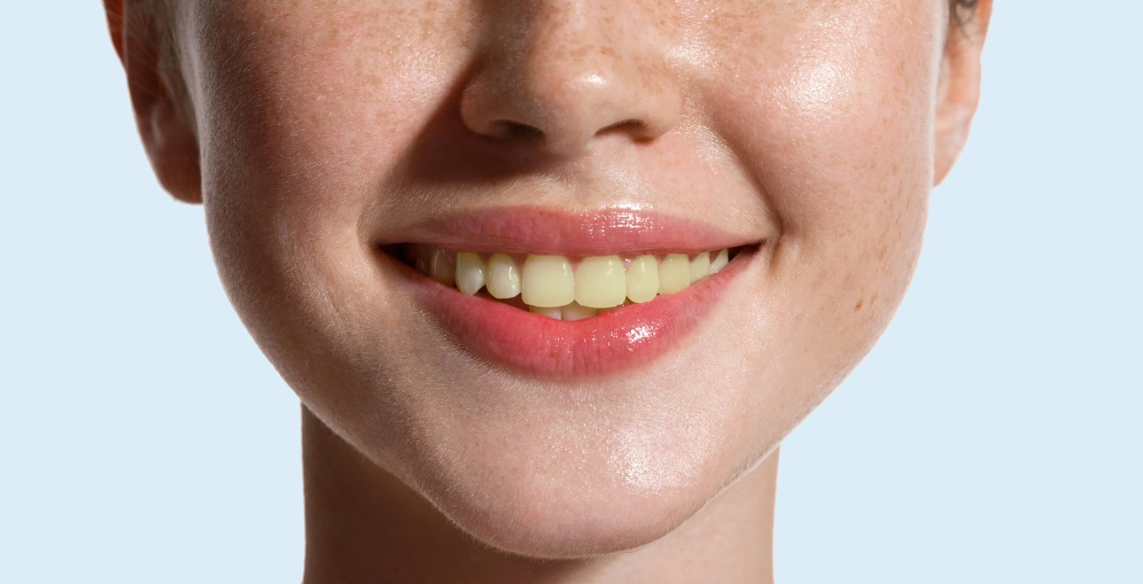 before-after-image of teeths